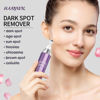 Picture of HANYWIL Dark Spot Remover for Face and Body, Dark Spot Corrector Serum, Age Spot Sun Spot Freckles Brown Spot Remover, Melasma Treatment for Face, Skin Care Face Serum with Roller (0.5 Fl Oz)