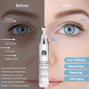Picture of Eye Serum, Under Eye Cream For Dark Circles, 8% Caffeine Eye Serum For Women & Men, Eye Cream Anti Aging With 360° Massage Ball, Eye Cream For Puffiness And Bags Under Eyes, Eye Serum For Fine Lines