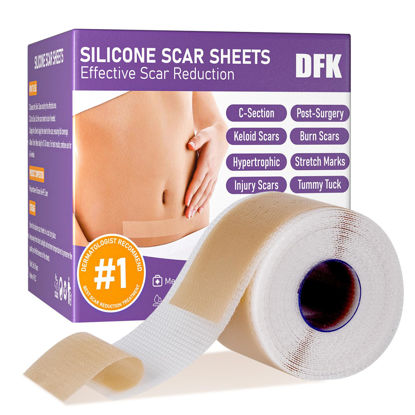 Picture of Silicone Scar Sheets, Silicone Scar Tape(1.6"x 79" Roll-2M), Reusable Professional Scar Silicone Strips, Soft Silicone Scar Sheets for Surgical Scars,Keloid,Acne Scars,Burn Scar,C-Section
