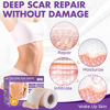 Picture of Silicone Scar Sheets, Silicone Scar Tape(1.6"x 79" Roll-2M), Reusable Professional Scar Silicone Strips, Soft Silicone Scar Sheets for Surgical Scars,Keloid,Acne Scars,Burn Scar,C-Section