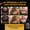 Picture of 5% Minoxidil for Men Hair, Minoxidil for Women Hair Growth, Minoxidil for Men Beard Growth, Minoxidil 5 Percent, Hair Regrowth for Men, Hair Loss Treatments for Women 1oz