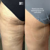 Picture of MAËLYS Cosmetics B-TIGHT Leave-On Cellulite Mask - Reduces The Appearance Of Cellulite - Visibly Tightens The Skin In The Butt Area