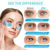 Picture of Under Eye Patches for Puffy Eyes - 24 Pairs Retinol Collagen Eye Gel Pads, Reduce Wrinkles, Puffy Eyes, Eye Bags - Eye Mask Skincare, Anti Aging & Face Moisturizer - Valentine's Day Gift