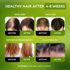 Picture of Batana Oil for Hair Growth - 100% Raw & Organic Dr Sebi Batana Oil - Cold-Pressed & Pure Unrefined Batana Hair Mask for Women & Men - Enhances Hair Thickness, Prevents Loss, Eliminates Split Ends