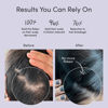 Picture of Jupiter, Physician-Formulated Anti-Dandruff Shampoo & Conditioner, for Flaky, Itchy, Oily, Dry Scalp, Vegan, Sulfate-Free, Color-Safe, & Paraben-Free, Dry Scalp Shampoo and Conditioner for Women & Men