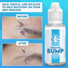 Picture of DR. PIERCING AFTERCARE Keloid Drops - Non-Greasy Saline Solution for Keloid Bump Removal for Piercings - Reduce Appearance of Nose Piercing Bump, Nose Ear Lip Belly (15 mL, 3-Pack)