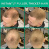 Picture of THICK FIBER Hair Building Fibers for Bald Spots & Thinning Hair (LIGHT BROWN, Pack of 2) - 25g Bottle - Conceals Hair Loss in Seconds - Hair Fibers for Men & Women