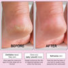 Picture of grace & stella Award-Winning Foot Peel Mask - Foot Peeling Mask with Aloe Vera - Moisturizing Foot Mask for Dry Cracked Feet - Foot Exfoliator for Baby Soft Feet (4 Pairs, Lavender)
