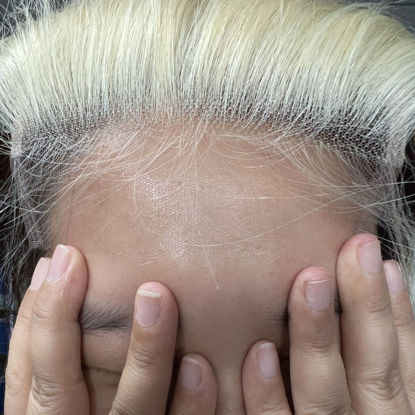 Picture of BEEOS 5x5 Skinlike Real HD Lace Closure Only, 613 Blonde 0.10mm Ultra-thin Invisible Swiss Lace Ultimate Human Hair Closure Pre-Plucked Natural Hairline Silky Straight 20 Inch