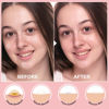 Picture of 72 Counts Pimple Patches for Face Hydrocolloid Acne Patches for face Invisible Zit Patches for Face Pimple Patch Acne Spot Patch Blemish Patches Cover Patches Stickers
