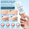 Picture of Advanced Scar Cream, Silicone Scar Gel, Treats Old and New Scars, Reduces the Appearance of Scars from, Body, Face, Stretch Marks, Surgical Scar, Keloids, Acne, Burns and More, 1.7 oz
