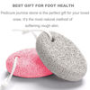 Picture of Natural Foot Pumice Stone for Feet, Borogo 2-Pack Lava Pedicure Tools Hard Skin Callus Remover for Feet and Hands - White&Red