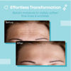 Picture of Forehead Wrinkle Patches Reusable | Non-Invasive Wrinkle Treatment for Fine Lines | Works with Face Lift Tape and Eye Patch Kits | Long-Lasting, Gentle Skin Care Solution | Includes Storage Tin