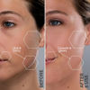 Picture of Michael Todd Beauty - Sonicsmooth Pro+ Dermaplaning Blade Refills - 8 Dermaplaning Blades- 2 Month Supply - Device Not Included