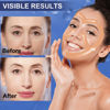 Picture of Anti-Wrinkle Tape | Facial Myofascial Lift Tape for Skin Firming, Toning & Tightening | Lift Tape for Face, Neck & Forehead | Smooths Wrinkles, Lifts Skin Anti-Aging Face Patches 2 rolls