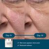 Picture of ELEMIS Dynamic Resurfacing Pads, Exfoliating Pads, Toner Pads, Chemical Exfoliant Face Toner, Lactic Acid Peel, Facial Cleansing Pads, Chemical Peel for Face