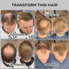 Picture of THICK FIBER Hair Fibers for Thinning Hair & Bald spots (LIGHT BROWN) - 25g Bottle - Conceals Hair Loss in Seconds - Hair Powder for Women & Men