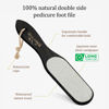 Picture of Pumice Stone Foot Scrubber - Pedicure Foot File with Handle for Dry Dead Skin - Callus Remover for Feet - Foot Scraper - Exfoliating Brush for Heels, Elbows, Hands