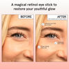 Picture of grace & stella Under Eye Balm Stick - Under Eye Brightener - Retinol & Caffeine Eye Cream for Anti-aging, Dark Circles, Puffiness, Wrinkles - Niacinamide & Peptides - Vegan Skincare (0.13 oz/3.5 g)