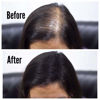 Picture of THICK FIBER Hair Fibers for Thinning Hair & Bald Spots (BLACK, Pack of 2) - 25g Bottle - Conceals Hair Loss in Seconds - Hair Powder for Women & Men