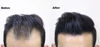 Picture of THICK FIBER Hair Building Fibers for Thinning Hair & Bald Spots (BLACK, Pack of 3) - 25g Bottle - Conceals Hair Loss in Seconds - Hair Fiber concealer for Men & Women