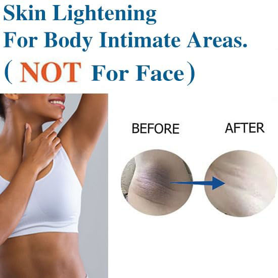 GetUSCart- Skin Whitening Cream For Private Parts, Underarm, Knees ...