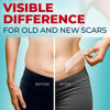 Picture of Medical Grade Silicone Scar Tape - Transparent (1.6”x120”) - Visible Difference on Surgical & Keloid Scars - Reusable Silicone Scar Sheets - Easy to Use Silicone Tape for Scars