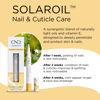 Picture of CND SolarOil Essential Care Pen, Moisturizes and Conditions Nails, Natural Blend Of Jojoba, Vitamin E, Rice Bran and Sweet Almond Oils, Pack Of 1, 0.08 oz. (Packaging may vary)