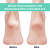 Picture of Vaincre Gel Moisturizing Heel Socks for Dry Cracked Feet Women, 4 Pairs Foot Care Spa Moisture Toeless Socks for Cracked Heel Repair Treatment Overnight (Regular)