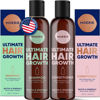Picture of Moerie Volumizing Shampoo and Conditioner for Hair Loss - Thickening Products with Ingredients of Natural Origin - Over 100 Active Ingredients for Thick, Long, Luscious Hair, 2 X 8.45 Fl Oz