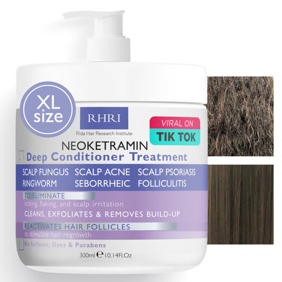 Picture of Anti Fungal Deep Conditioner for Men and Women | Scalp Treatment for Psoriasis, Dandruff, Seborrheic Dermatitis | Provides Relief from Folliculitis, Eczema, Itchy , Flaky and Dry Scalp