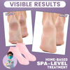Picture of 5 Pairs Silicone Socks for Dry Cracked Feet, Silicone Socks for Women, Silicone Foot Socks, Silicone Socks for Moisturizing Feet, Cracked Heel Treatment (5 Colors Assorted, Fits Up to Size 10)