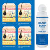 Picture of Razor Bump Stopper with Ingrown Hair Treatment: Razor Bumps Treatment for Men and Women, After Shave Solution for Ingrown Hairs and Razor Burns, Roll on Applicator- 3.38 Fl Oz
