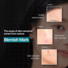 Picture of Mediheal Madecassoside Essential Sheet Mask Blemish Repair 10 pcs. 98% Purity Madecassoside & Hyaluronic Acid Included. Enhancing Moisture Barrier & Skin Texture Care. Vegan Formula Sheet Mask