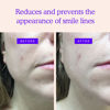 Picture of BLUMBODY Face Wrinkle Patches - Anti Wrinkle Facial Patches to Smooth Smile Lines - Non-Silicone Face Patches Wrinkles Tape for Fine Wrinkles between Eyes & Face - For Overnight Wrinkle Use