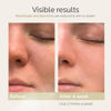 Picture of Colorfarm Facial Steamer Nano Ionic: Face Steamer Deep Cleaning Unclogs Pores - Humidifier Hot Mist Home Sauna Spa for Women Men Sinuses Moisturizing