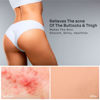 Picture of BellamiLuxx Butt Acne Clearing Treatment: with 2% Salicylic Acid and Tea Tree Oil, Effective Body Acne Treatment and Folliculitis Treatment, Butt Acne Cream for Reduce Body Acne