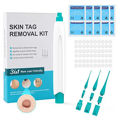 Picture of Facepos Auto Skin Tag Remover, 3 in 1 Painless Safe Skin Tag Removal Kit for Small to Large Skin Tags (2mm to 8mm), Micro Tag Remover Pen with 66 Removal Bands and 10 Cleansing Wipes
