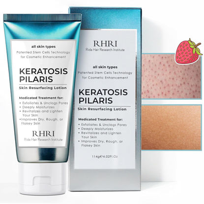 Picture of Keratosis Pilaris Lotion with Glycolic Acid, AHA & BHA Exfoliating | Strawberry Legs, KP & Ingrown Hair Treatment | Bumpy Skin Body Lotion | Moisturizing Cream for Redness, Dry, Rough & Flakey Skin