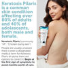 Picture of Keratosis Pilaris Lotion with Glycolic Acid, AHA & BHA Exfoliating | Strawberry Legs, KP & Ingrown Hair Treatment | Bumpy Skin Body Lotion | Moisturizing Cream for Redness, Dry, Rough & Flakey Skin