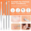 Picture of Pimple Popper Tool Kit, IUMAKEVP 15 PCS Professional Stainless Steel Blackhead Remover Comedone Extractor Tools for Removing Zit on Face - Acne Removal Kit with Metal Case (Silver)