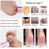Picture of Electric Foot File Callus Remover Professional Foot File Pedicure Tools Adjustable Speed 60pcs Replacement Sandpaper disc Easy to Remove Cutin Dead Skin calluses(Rose Gold 60pcs)
