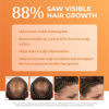 Picture of BosleyMD BosRevive Volumizing Conditioner for Noticeably Thinning and Color/Chemically-Treated Hair, 33.8 Fl Oz