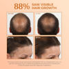 Picture of BosleyMD BosRevive Volumizing Conditioner for Noticeably Thinning and Color/Chemically-Treated Hair, 10.1 fl oz.
