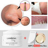Picture of LANBENA Blackhead Remover, Nose Pore Strips for Blackheads, Black Head Remover Mask for Face, Puntos Negros, 30g+60pcs paper