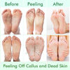 Picture of 5 Pack Foot Peel Mask,Exfoliator Peel Off Calluses Dead Skin Callus Remover,Foot Mask for Dry Cracked Feet,Foot Peel Mask for Men and Women Feet Peeling Mask for Valentines Day Gifts