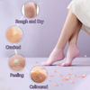 Picture of TEAWOO 5 Pairs Moisturizing Socks (2 Silicone Socks & 3 Heel Socks) for Dry Cracked Feet, Spa Gel Socks Foot Care After Pedicure, Toeless Socks to Soften and Hydrate Feet Heels