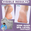 Picture of TEAWOO 5 Pairs Moisturizing Socks (2 Silicone Socks & 3 Heel Socks) for Dry Cracked Feet, Spa Gel Socks Foot Care After Pedicure, Toeless Socks to Soften and Hydrate Feet Heels
