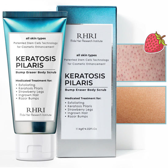 Picture of KP Bump Eraser Body Scrub, Keratosis Pilaris Treatment, Strawberry Legs Treatment for Women, Bump Eraser Body Scrub, Keratosis Pilaris, Body Scrub for Strawberry Legs