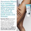 Picture of KP Bump Eraser Body Scrub, Keratosis Pilaris Treatment, Strawberry Legs Treatment for Women, Bump Eraser Body Scrub, Keratosis Pilaris, Body Scrub for Strawberry Legs